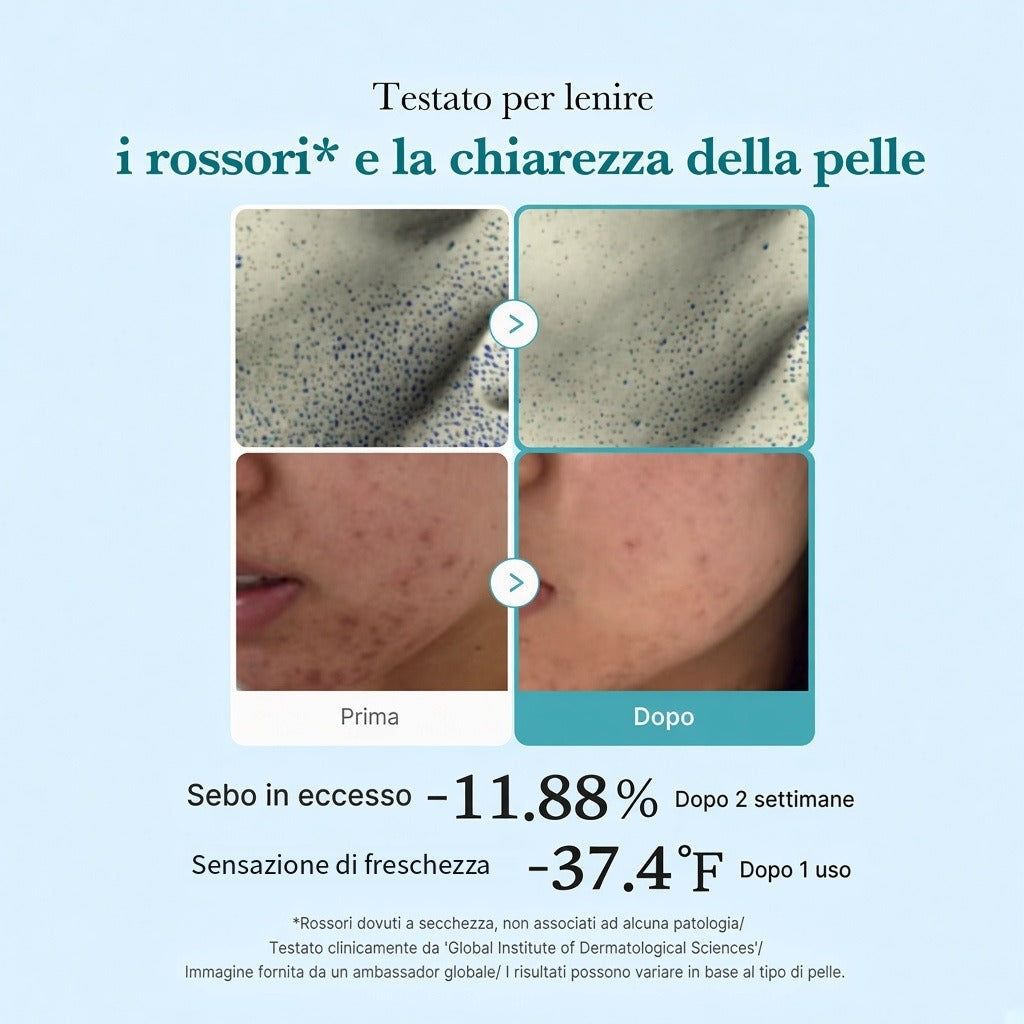 Tonico purificante Acido Azelaico e Niacinamide