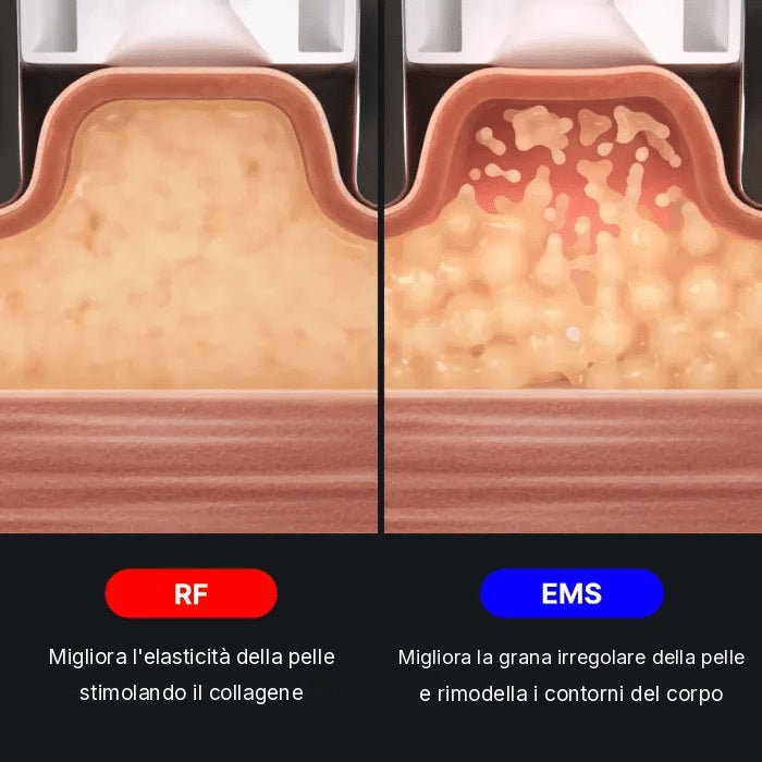 AGE-R Contour Body Shot