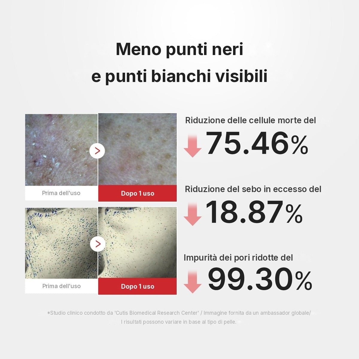 Peel Shot al Riso e Acido Ipocloroso