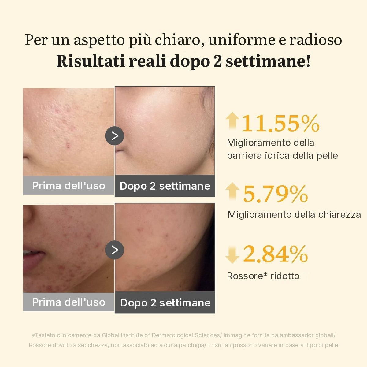 Siero in capsule Acido Cogico e Curcuma