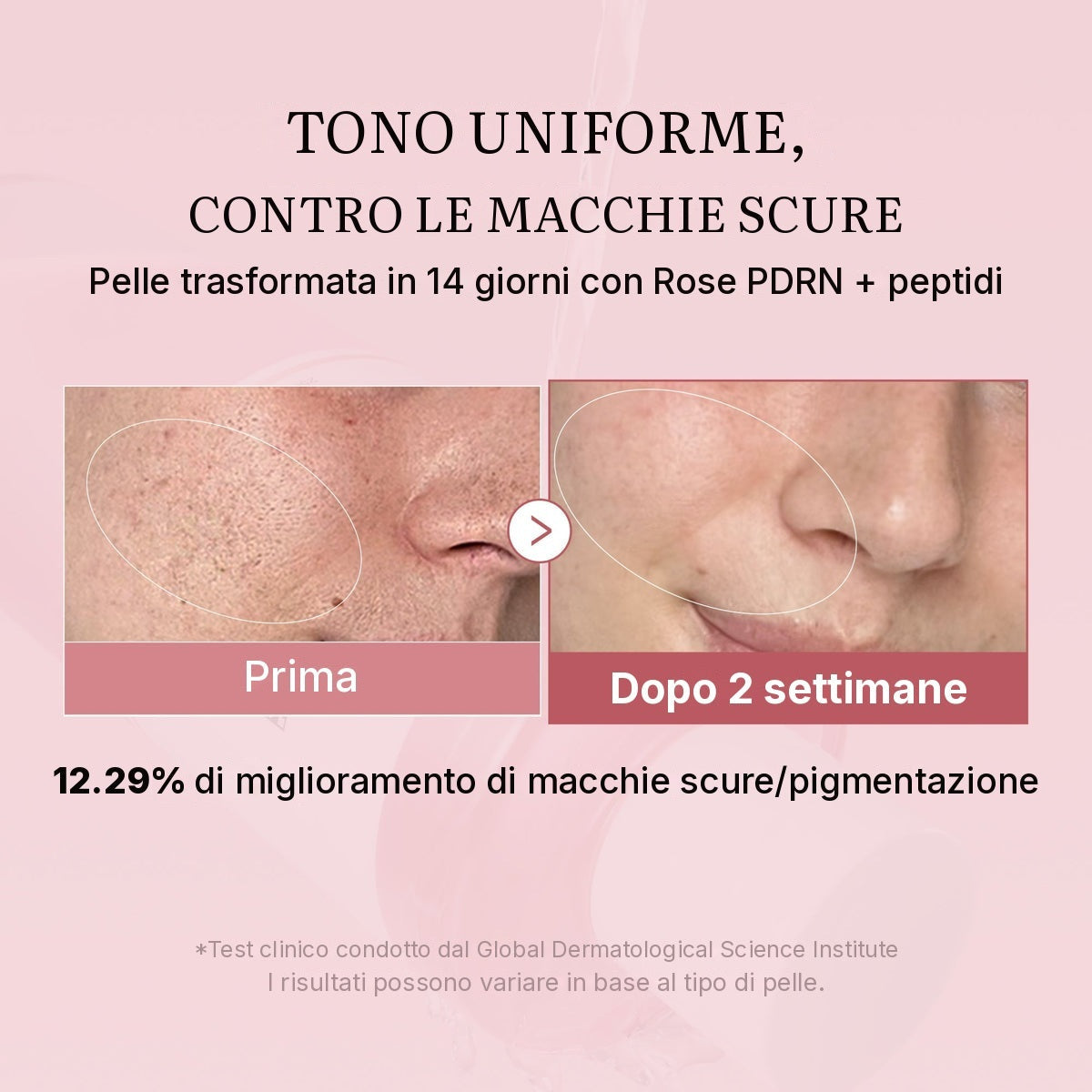 Tonico PDRN Pink ai Peptidi