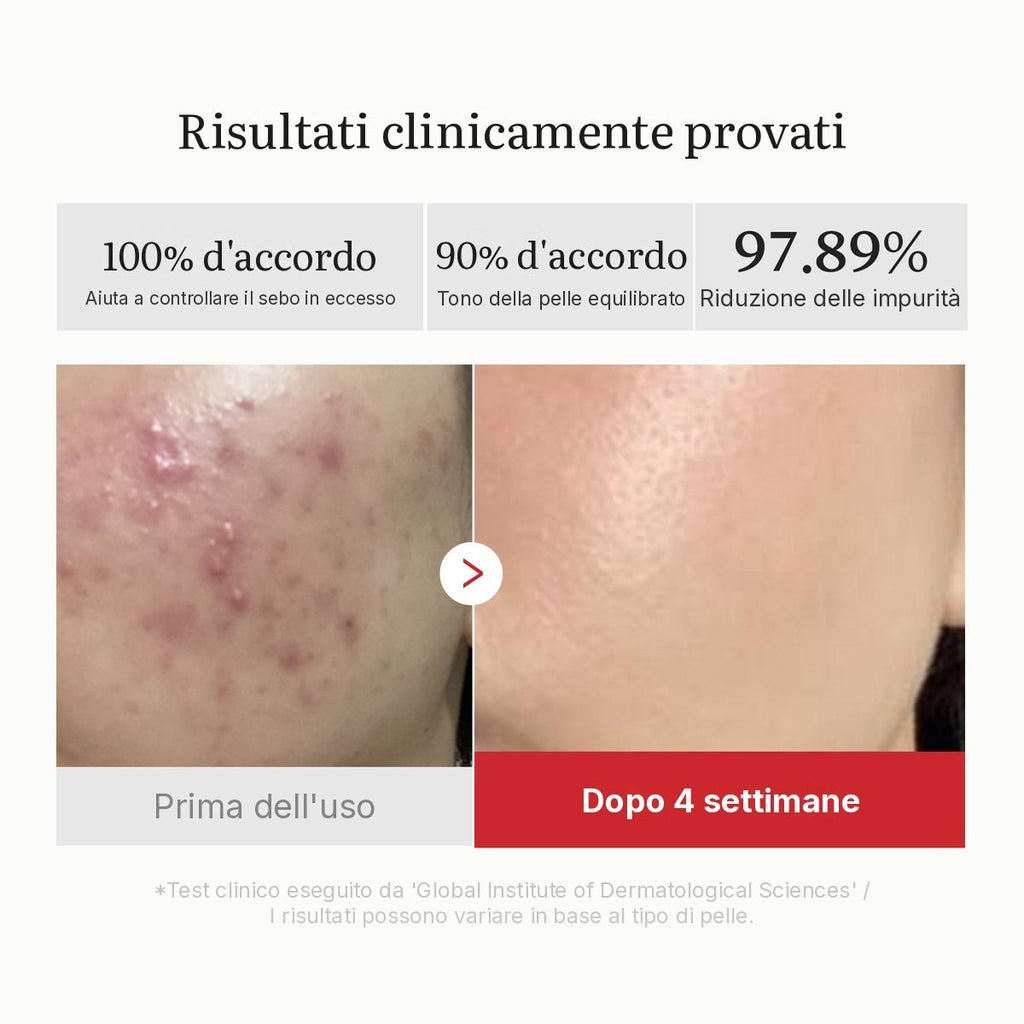 Dischetti Red Acido Succinico e Pantenolo
