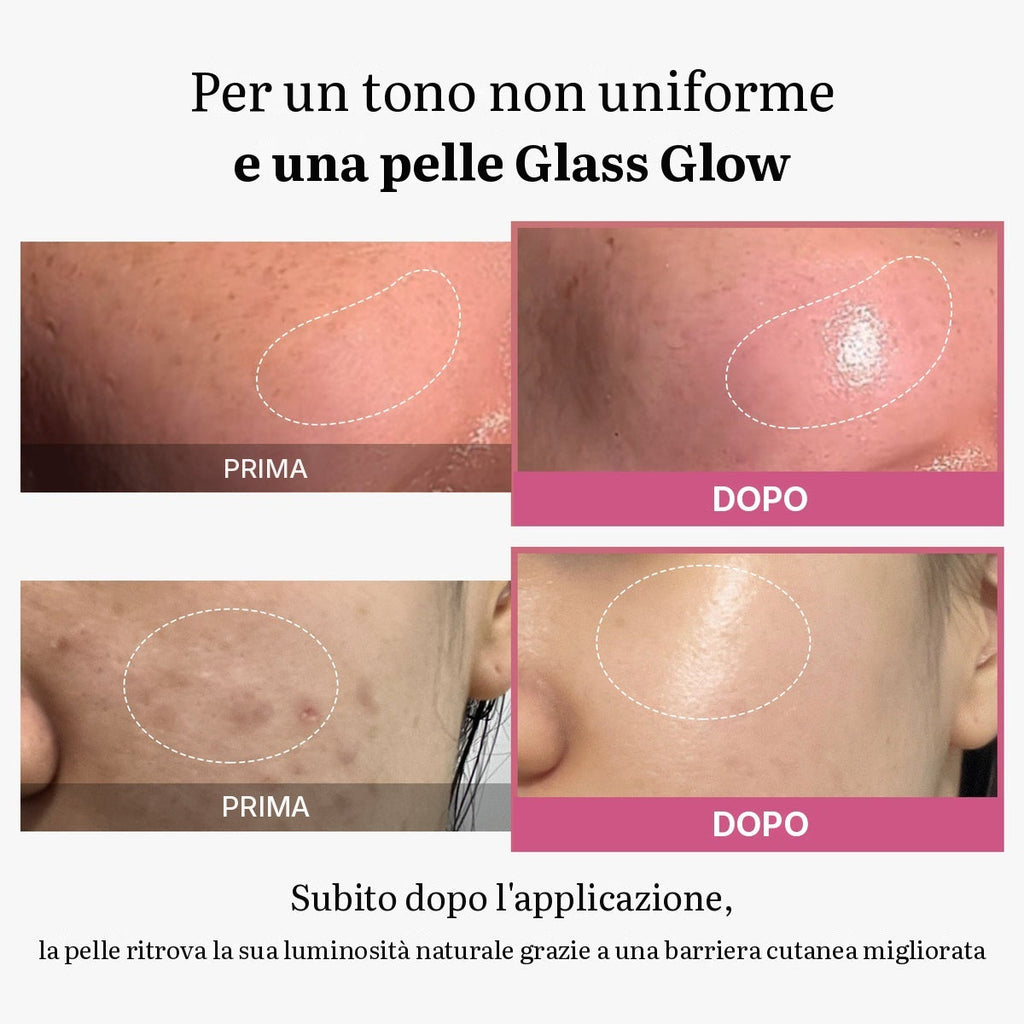 [Tati's Exclusive] Set Plump Perfection